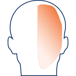 Migraine Headache