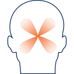 Sinus Headache