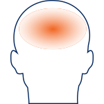 Tension Headache